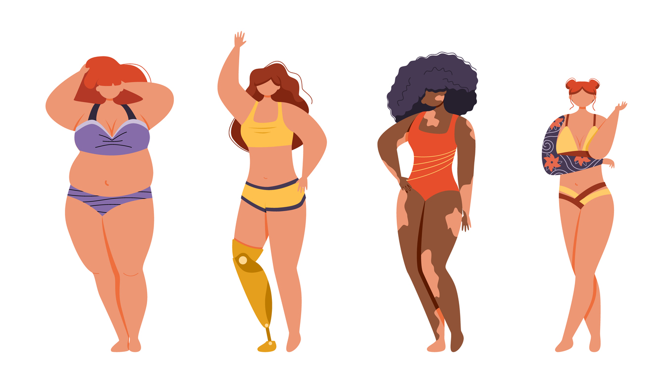 Das Bild zeigt verschiedene weiblich gelesene Körper, eine Person ist dick, eine Person ist Schwarz und hat auffällige Pigmentstörungen, eine weitere Frau hat nur einen Arm und trägt am anderen eine Prothese.